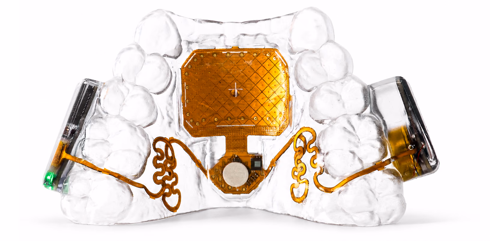 The MouthPad seen from the front: a clear custom-fit retainer with a gold touchpad at its center and gold flexible circuitry curving out to the side electronics, one of which shows a small green status light, lit against a white field.